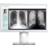 Dell Medical Review 21.5 (MR2217)