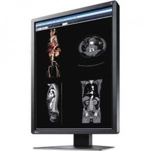 EIZO RadiForce MX MX216-BK