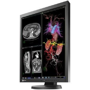 Eizo RadiForce MX215 21.3 (MX215-BK)