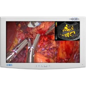 NDS Surgical Imaging Radiance G2 26 (90R0051)